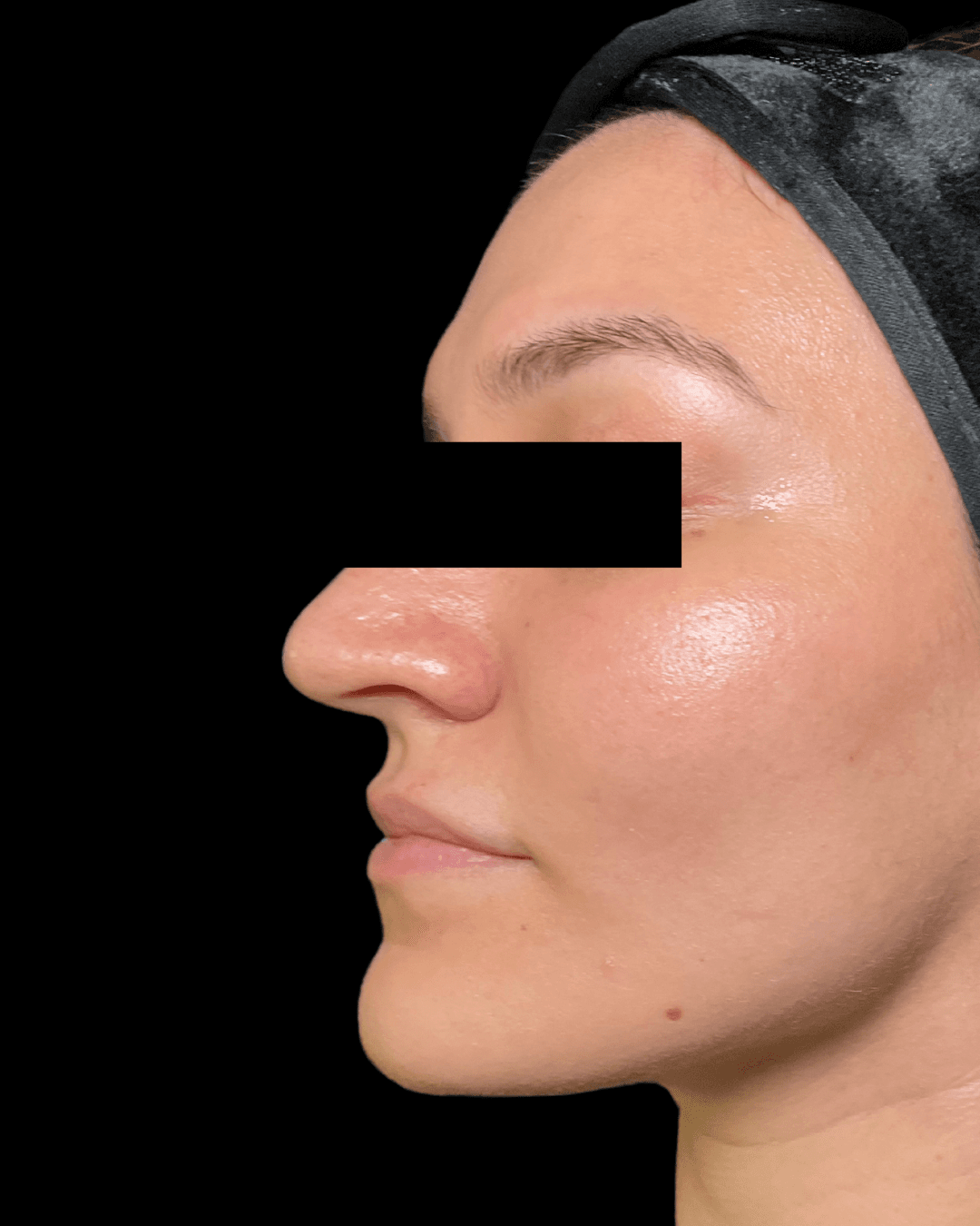 Jan Marini Enzyme Facial After