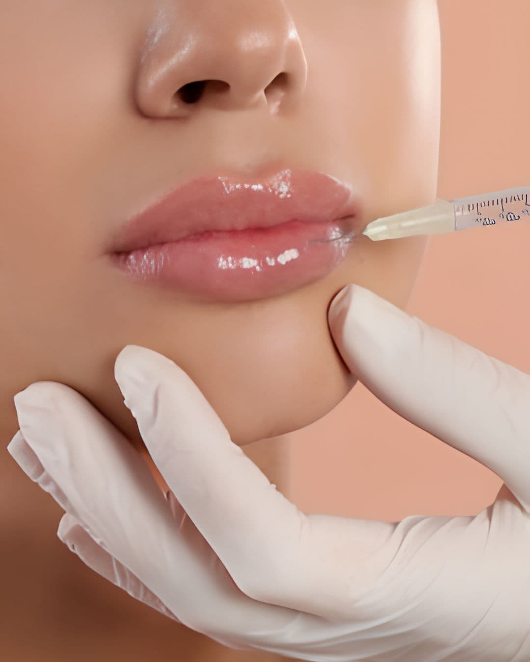 Fillers