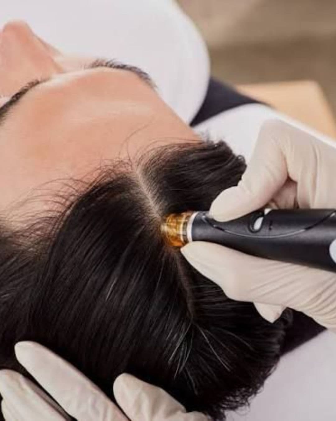 Hair Restoration
